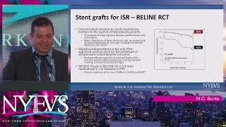 Endovascular Management of Femoropopliteal In Stent Restenosis What Is My Algorithm Matthew C B [upl. by Ettennat]