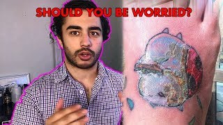 Is your tattoo INFECTEDOVERWORKED and what to do about it [upl. by Adierf]