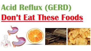 Worst Foods to Eat with Acid Reflux GERD Gastroesophageal Reflux Disease  How to Reduce Symptoms [upl. by Flossy]