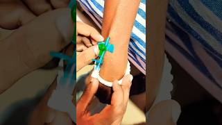 Jelco procedure IV Cannula seting and saline given hospital medical technology short viral [upl. by Starobin]