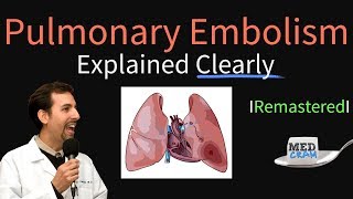 Pulmonary Embolism Remastered  Pathophysiology Symptoms Diagnosis DVT [upl. by Tally]