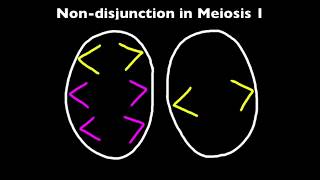 33 Nondisjunction and Down Syndrome [upl. by Teak]