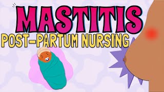 MASTITIS Maternal Newborn Nursing [upl. by Dlabihcra]