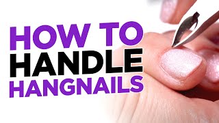 How to Safely Handle Hangnails [upl. by Hiram]