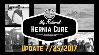 My Natural Hernia Cure Update 7252017 [upl. by Papagena]