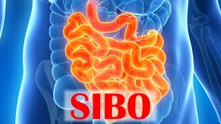 Small Intestinal Bacterial Overgrowth SIBO [upl. by Nellie963]