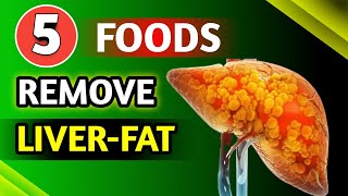 THIS REVERSES Fatty Liver In Just 14 Days Liver Detoxification Foods [upl. by Solenne695]