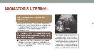 CASO CLINICO  HEMORRAGIA UTERINA ANORMALD [upl. by Aissat]