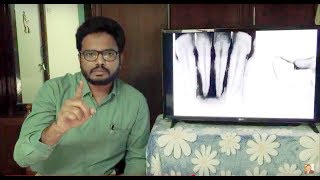 Image Based  MCQs Discussion  Periapical Lesions  Endodontics [upl. by Latisha]