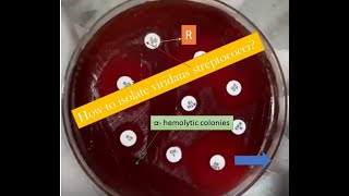 Viridans Streptococci Introduction isolation and pathogenesis [upl. by Sigismondo784]