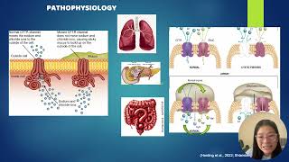 Cystic fibrosis [upl. by Gilles]