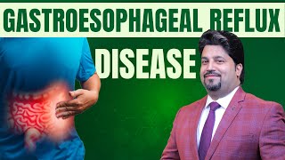 Gastroesophageal reflux disease I Nbp Unani amp Ayurveda Research Centre [upl. by Cob]