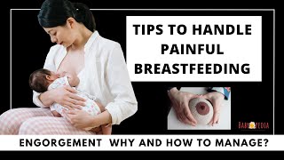 Tips to handle Painful Breastfeeding What is Breast Engorgement and How to handle them [upl. by Glovsky]