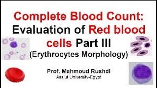 Complete Blood Count  Evaluation of RBCs Part III Erythrocytes Morphology Arabic Lecture 2017 [upl. by Elleunamme646]