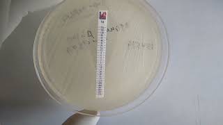 MIC of Vancomycin Determination for Staphylococcus aureus using Epsilometer I E Test Strip [upl. by Nonnaehr]