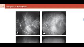 Kanski Clincal Ophthalmology Made Easy  macula 3 [upl. by Ronn425]