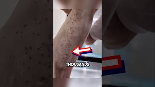 Extremely satisfying bug removal 😱 shorts oddlysatisfying [upl. by Tarrah544]