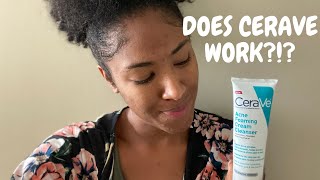 CERAVE ACNE FOAMING CLEANSER REVIEW [upl. by Ylrrad860]