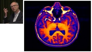 «Blick ins Gehirn – Bilder der Psyche» [upl. by Ennagem]