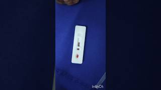 Malaria test in emergency ward emergency duty hospital nursing doctor subscribe mbbs [upl. by Howe]