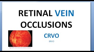 Ophthalmology CRVO Central Retinal Vein Occlusion Splashed tomato Thunder Ischemic RAPD glaucoma [upl. by Stratton]