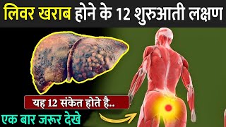 लिवर खराब होने में 12 शुरुआती लक्षण  12 Weird Signs Of Liver Damage  Liver Damage Signs In Hindi [upl. by Foulk]