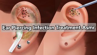 ASMR  Ear Piercing Cleaning Step by step Ear Wax removing Whitehead blackhead Asmr Animation [upl. by Anivel]