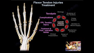 Flexor Tendon Injuries Treatment  Everything You Need To Know  Dr Nabil Ebraheim [upl. by Coraline718]