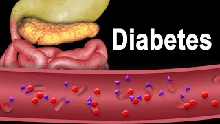 Diabetes Type 1 and Type 2 Animation [upl. by Flan]