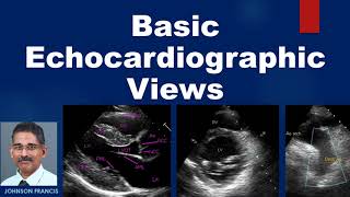 Basic Echocardiographic Views [upl. by Alesi]