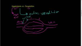 46Hyperemia vs Congestion [upl. by Uird]