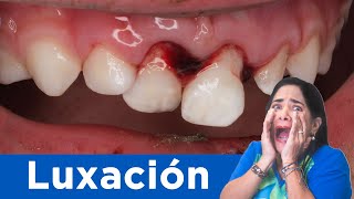 ⚠️ Luxación dental [upl. by Gaynor]