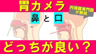 【胃カメラ】鼻からと口から、どちらがオススメ？内視鏡専門医が解説。 [upl. by Dnomar]