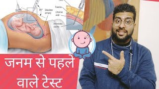 PRENATAL SCREENING TEST EXPLAINED IN HINDI [upl. by Wrennie]