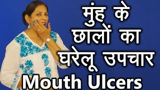 मुहं के छालों के घरेलू उपचार । Home remedies for Mouth Ulcers  Ms Pinky Madaan [upl. by Moise]