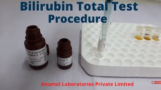 Bilirubin Test Procedure  Bilirubin Total Test [upl. by Narut878]