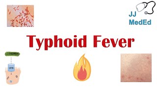 Typhoid Fever Pathogenesis vectors bacteria Symptoms Diagnosis Treatment Vaccine [upl. by Aiblis17]