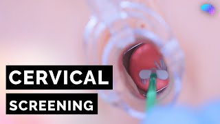 Cervical Screening Smear  HPV  OSCE Guide  UKMLA  CPSA [upl. by Ainet]