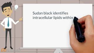 Sudan black stain in acute myelogenous leukemia [upl. by Chisholm]