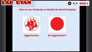 Blood Group Result Interpretation in tube and slide method [upl. by Ayekel]