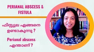 ഫിസ്റ്റുല amp Perianal abscess NO29By Dr Manju Kappen [upl. by Asirrom]