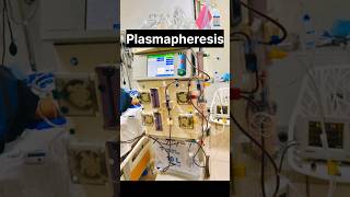 Plasmapheresis With Advanced Dialysis Machine nephrology kidneyhealth kidneydisease ytshorts [upl. by Washington544]