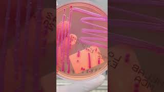 Cận cảnh B pseudomallei phát triển trên môi trường thạch whitmore labinsight shortvideo short [upl. by Adeehsar]