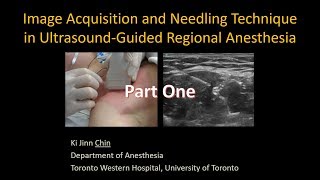 Image Acquisition and Needling in UltrasoundGuided Interventional Procedures  Part 1 [upl. by Cottle124]