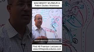 MACHINERY MURMUR In Patent Ductus Arteriosus shortvideo shorts drnajeeb lecture [upl. by Varrian]