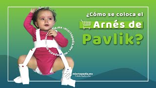 Explicación De Uso De Armés De Pavlik Para Tratamiento De Displasia De Caderas [upl. by Buckden]