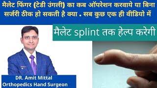 Mallet Finger Treatment In Hindi  मैलेट फिंगर की कब सर्जरी करवाये Everything about mallet finger [upl. by Jacquette]