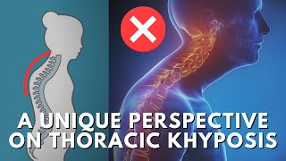 How To Fix The Root Cause Of Thoracic Kyphosis amp Upper Crossed Syndrome Hunchback Posture [upl. by Chas384]