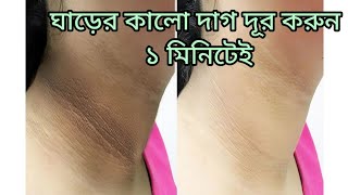 গলা ও ঘাড়ের কালো দাগ দূর করুন ১ মিনিটেই [upl. by Alexis913]