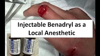 Injectable Benadryl as a Local Anesthetic [upl. by Tama582]